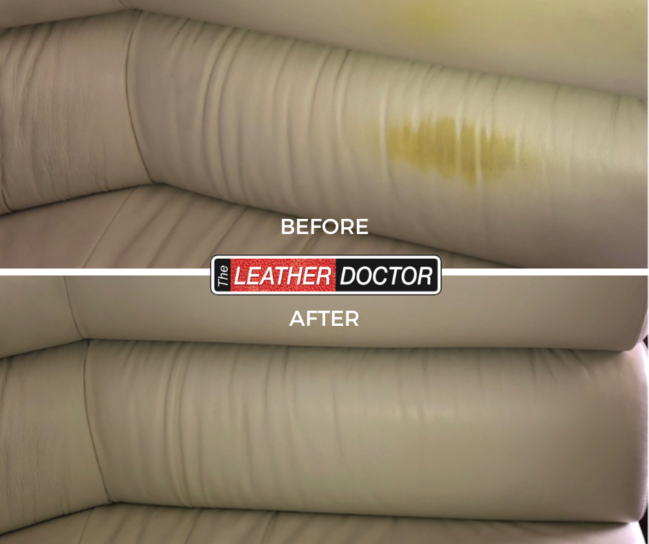 Yellow Discolouration BnA